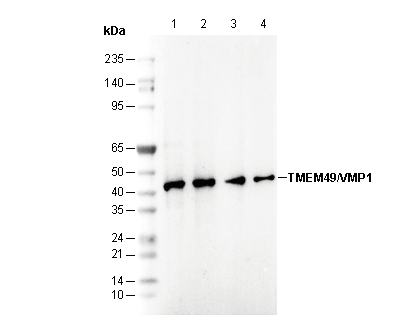 TMEM49/VMP1 Antibody