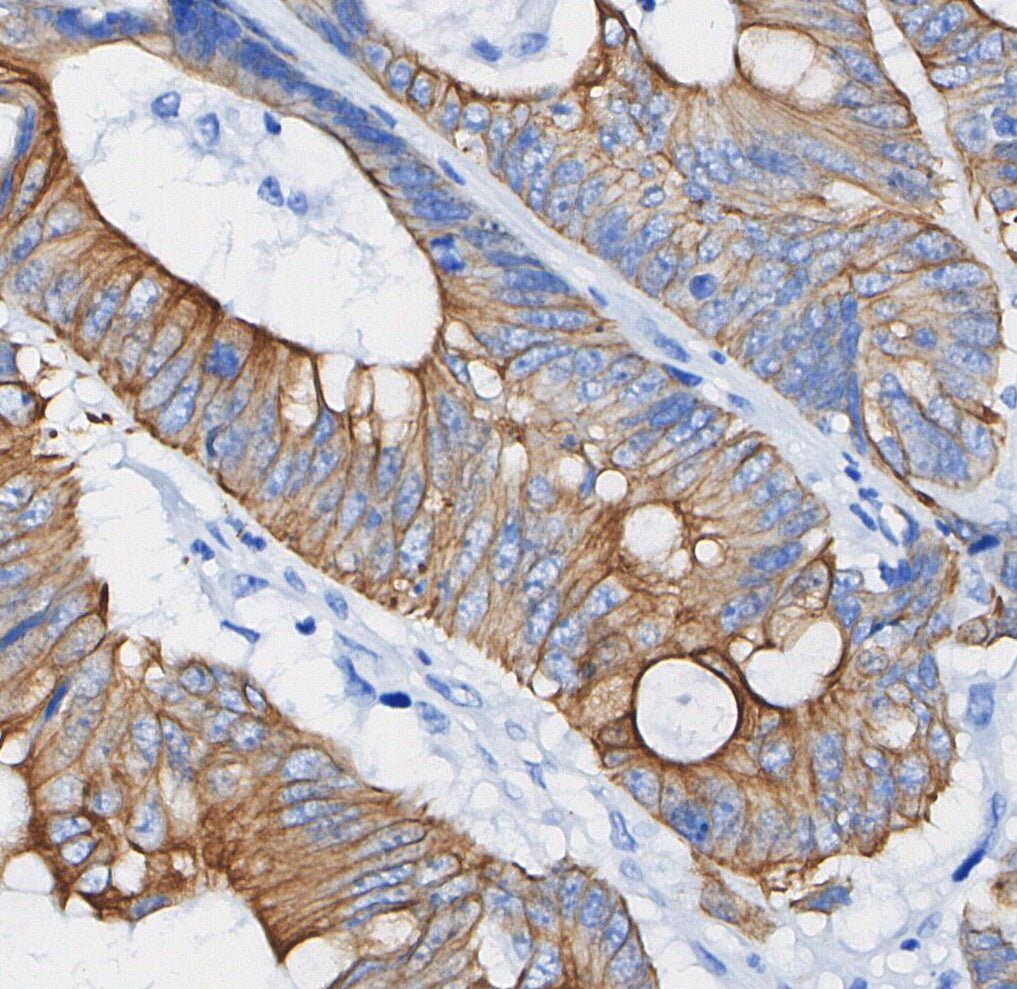 Keratin 17/19 Antibody