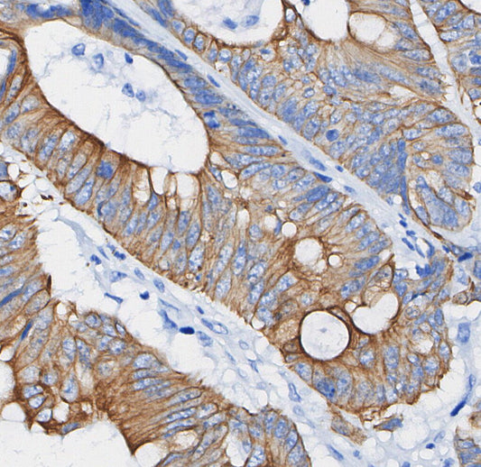 Keratin 17/19 Antibody