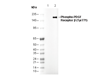 Phospho-PDGF Receptor β (Tyr771) Antibody