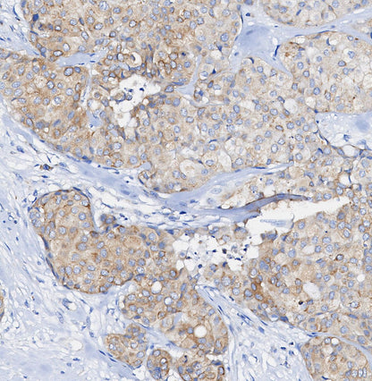 ERp44 Antibody