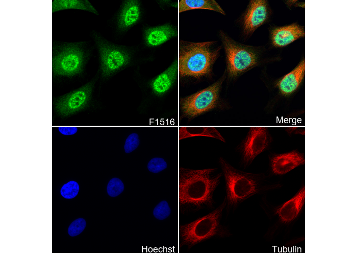 PIAS3 Antibody