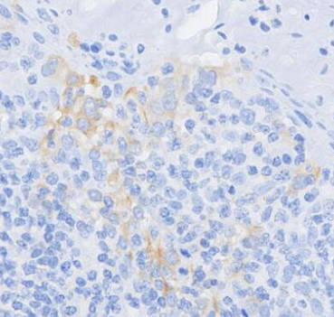 CXCL12/SDF-1 Antibody