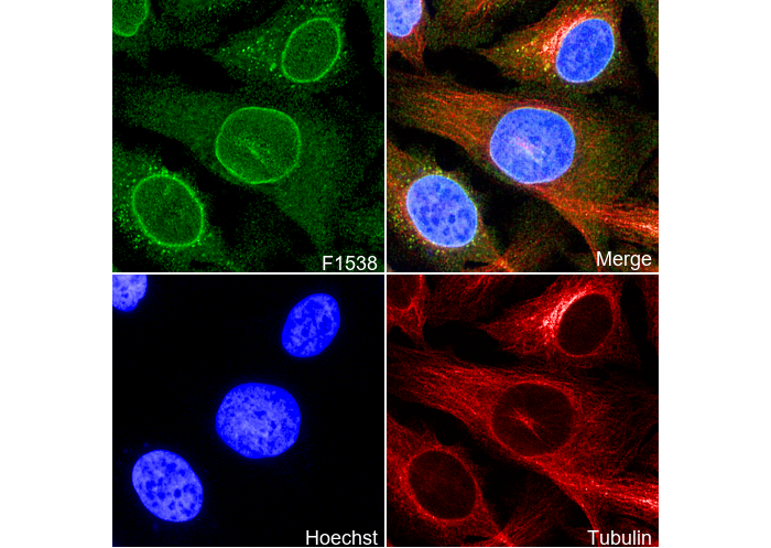 Nuclear Pore Complex Proteins Antibody