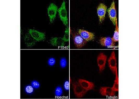 PDGFR α/β Antibody
