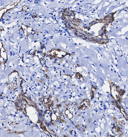 PDGFR α/β Antibody
