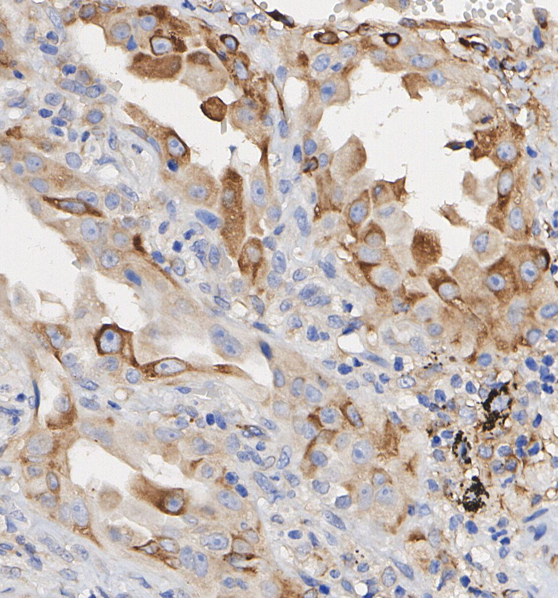 FGF21 Antibody