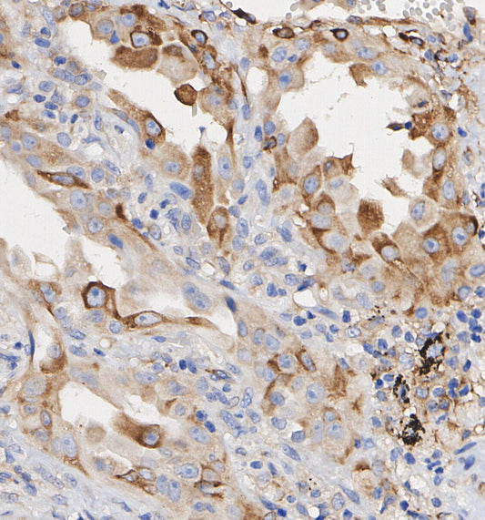 FGF21 Antibody