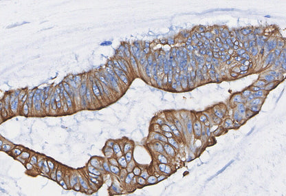 ACE2 Antibody