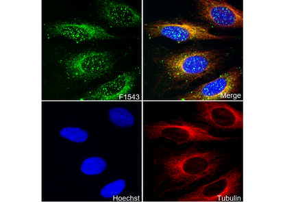 TSG101 Antibody