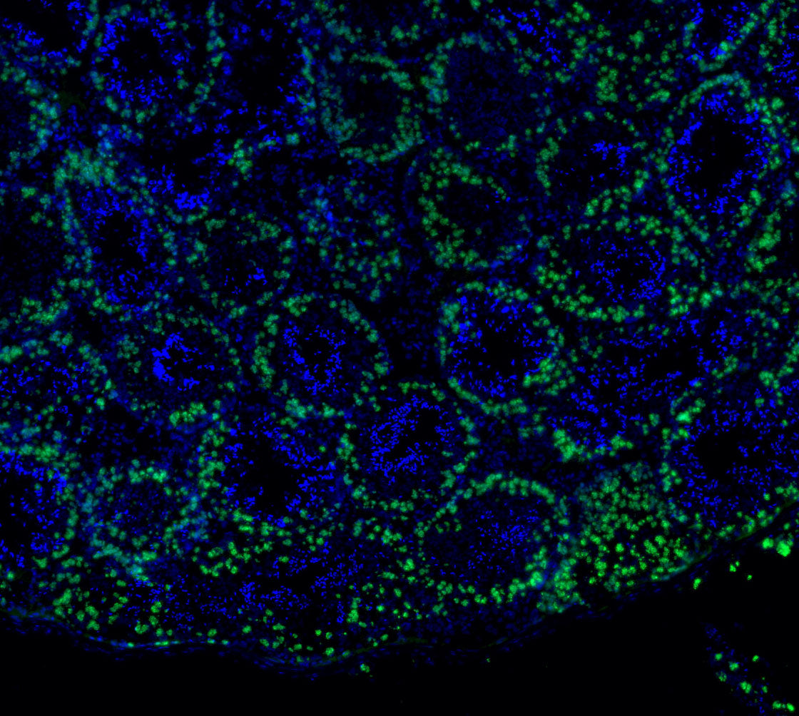 SCP3 Antibody