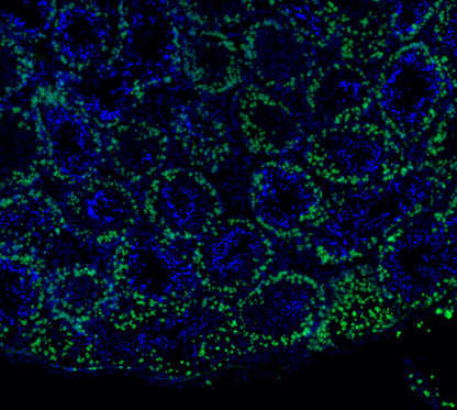 SCP3 Antibody