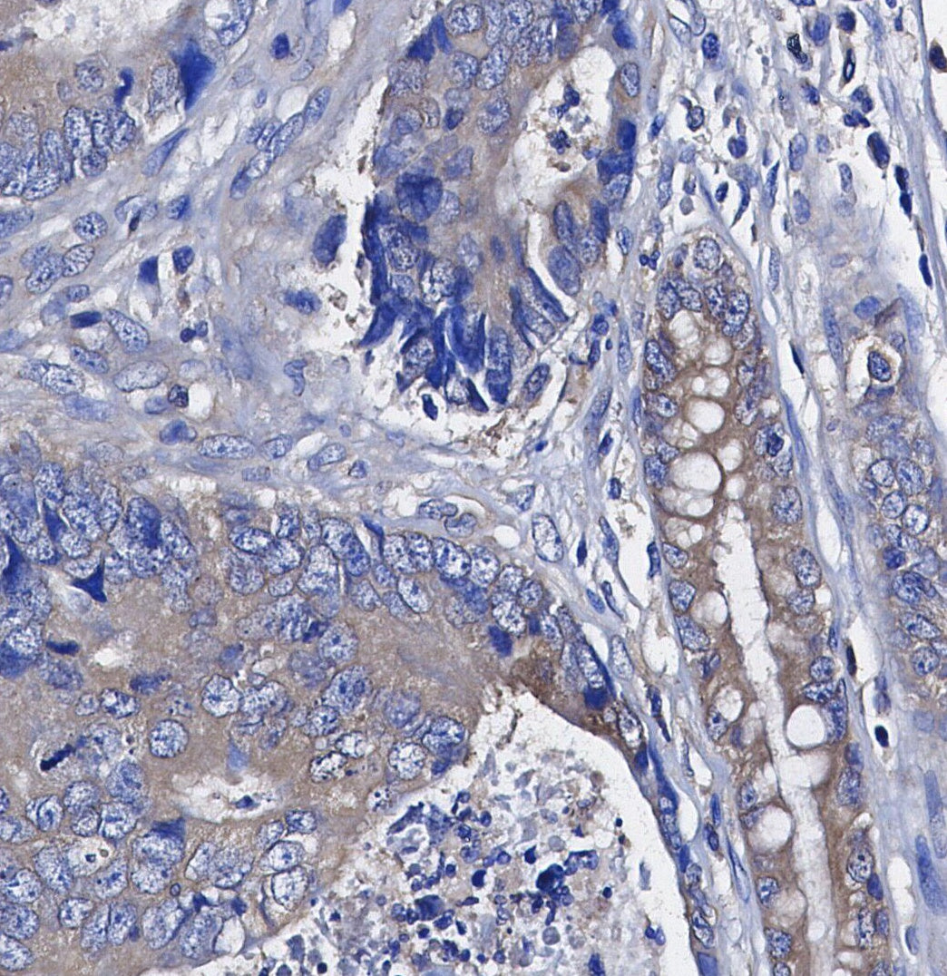 CD163 Antibody