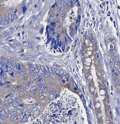 CD163 Antibody
