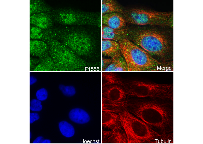 Phospho-Erk1 (T202/Y204)/Erk2 (T185/Y187) Antibody