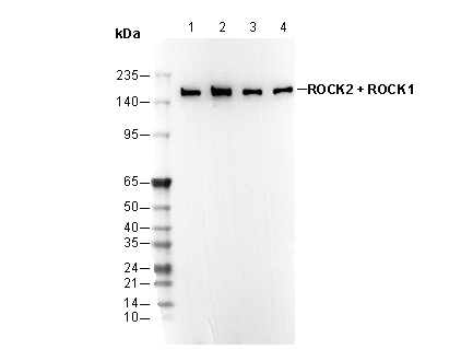 ROCK2 + ROCK1 Antibody