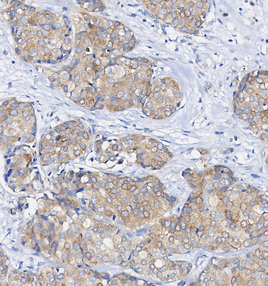 LRP1 Antibody