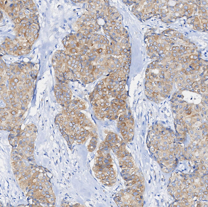 Tubulin Antibody
