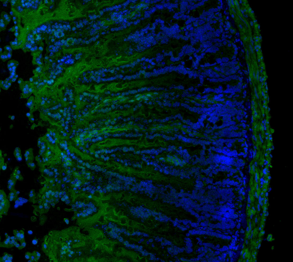 GSDMD Antibody