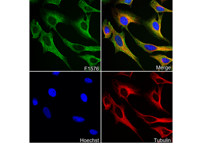 Cardiac Troponin T Antibody