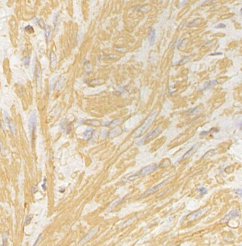 Cardiac Troponin T Antibody