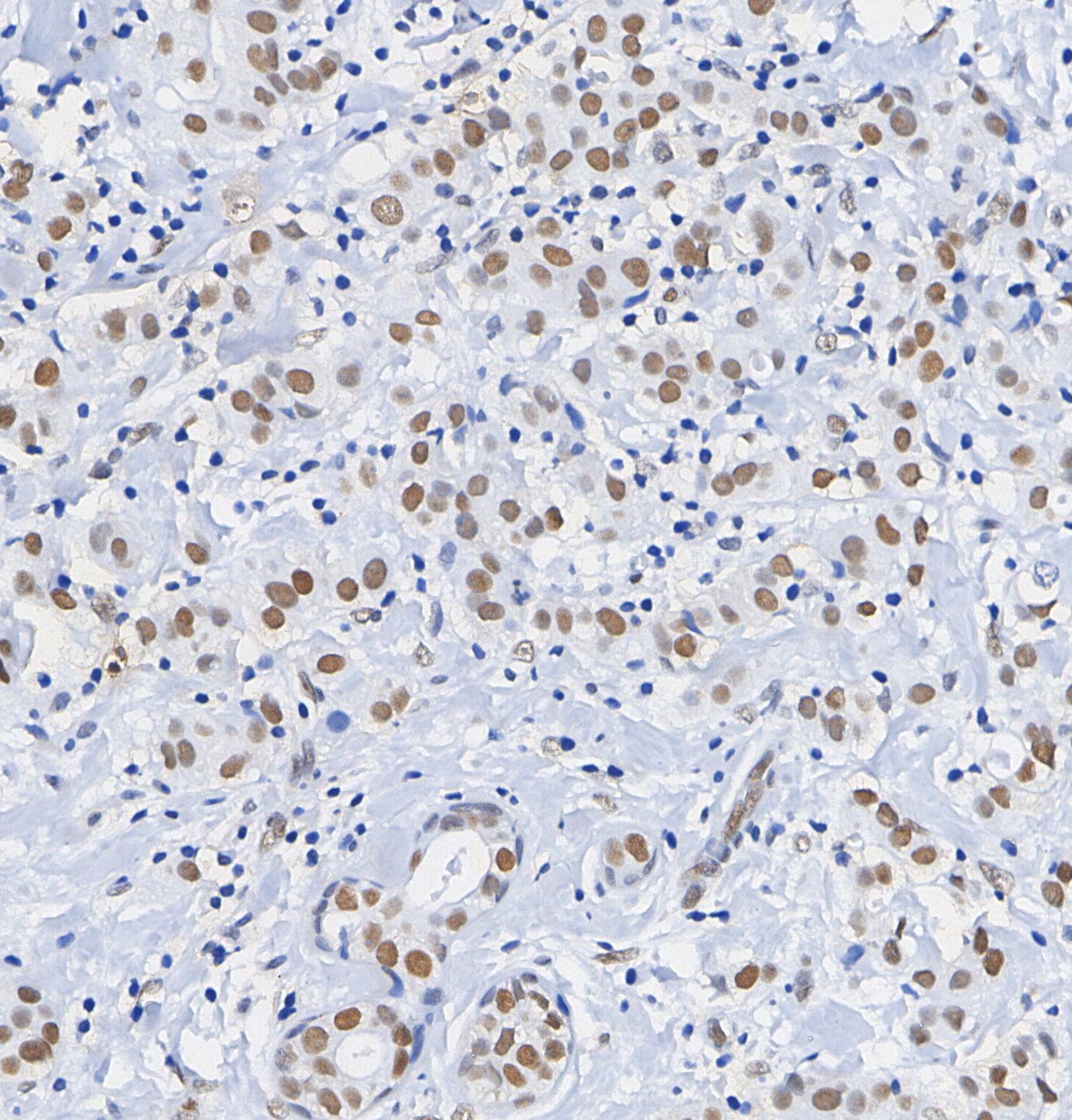 TTF1 Antibody