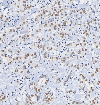 TTF1 Antibody