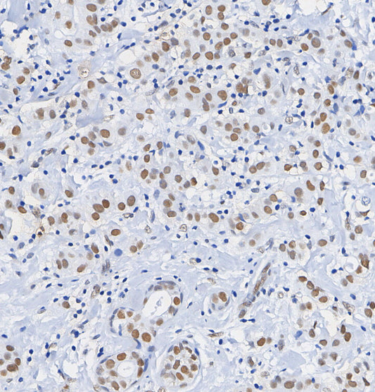 TTF1 Antibody