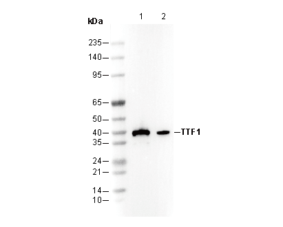 TTF1 Antibody