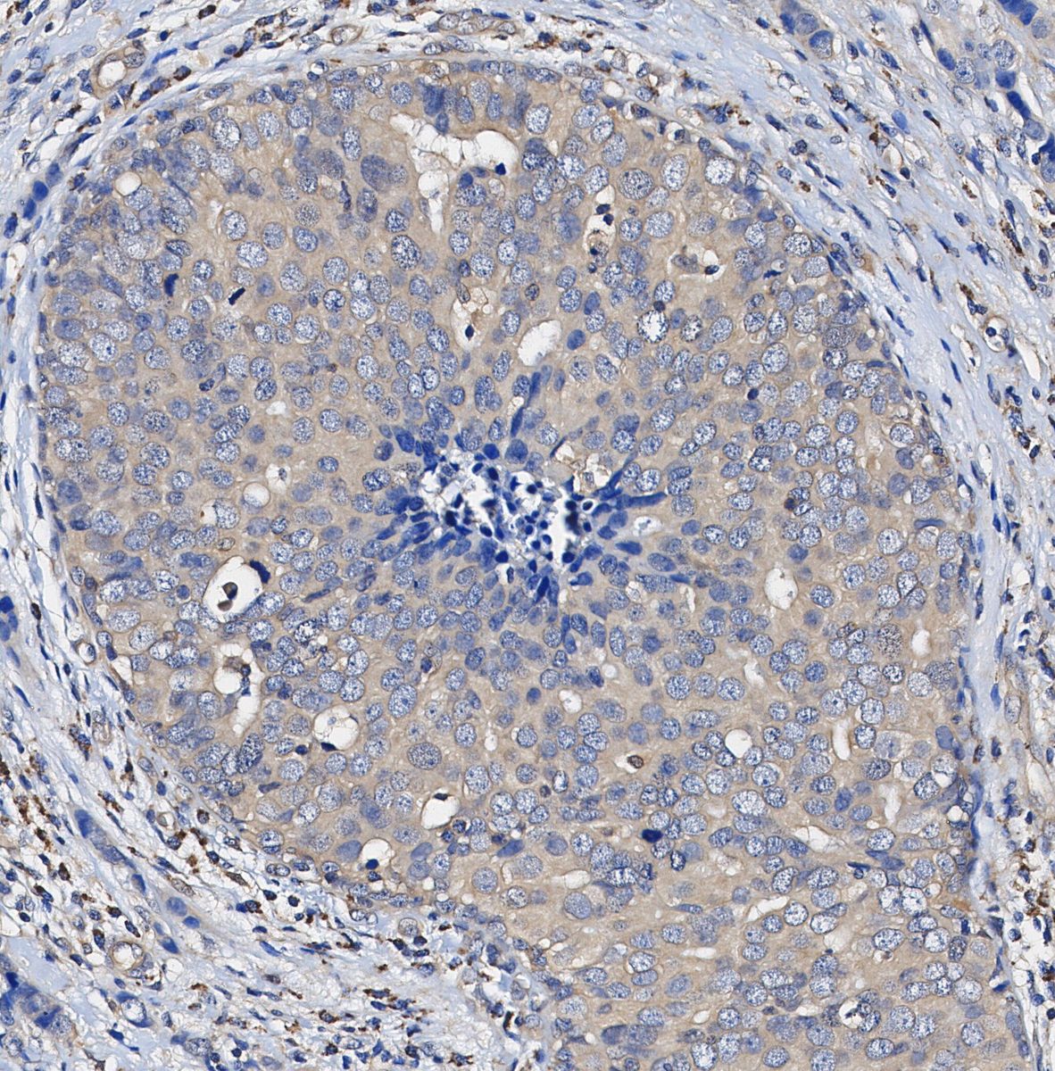 Glutathione Peroxidase 4 Antibody