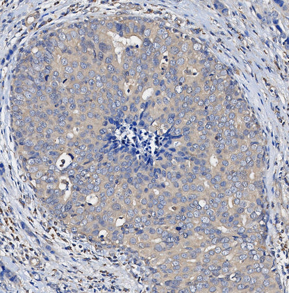 Glutathione Peroxidase 4 Antibody