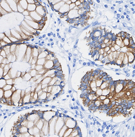 Somatostatin Receptor 2 Antibody