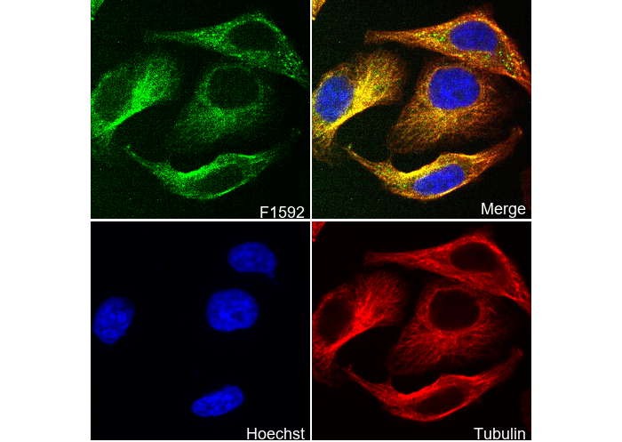 UQCRC2 Antibody