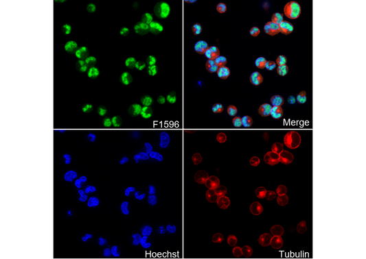 Wilms Tumor Protein Antibody