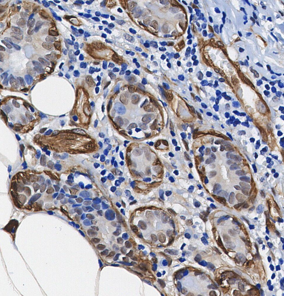 Wilms Tumor Protein Antibody