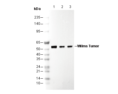 Wilms Tumor Protein Antibody