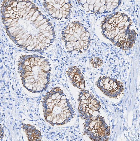 VEGF Receptor 1 Antibody