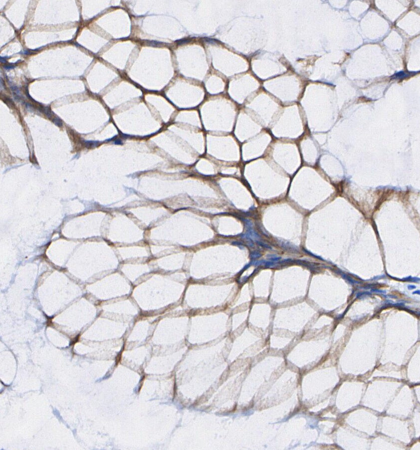 FABP4 Antibody