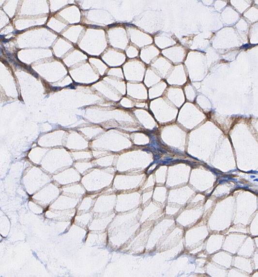 FABP4 Antibody