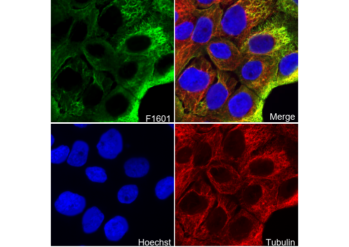 Cytokeratin 5 Antibody