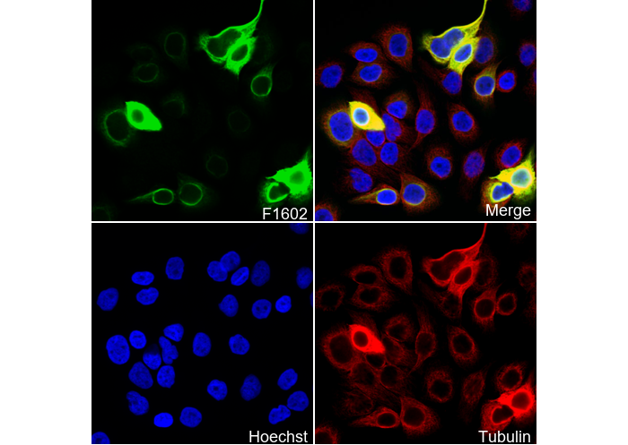 Cytokeratin 10 Antibody