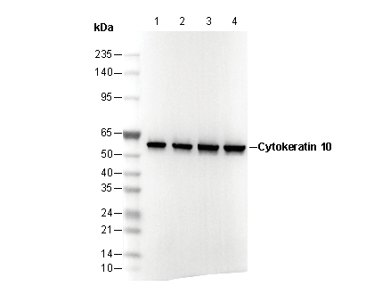 Cytokeratin 10 Antibody