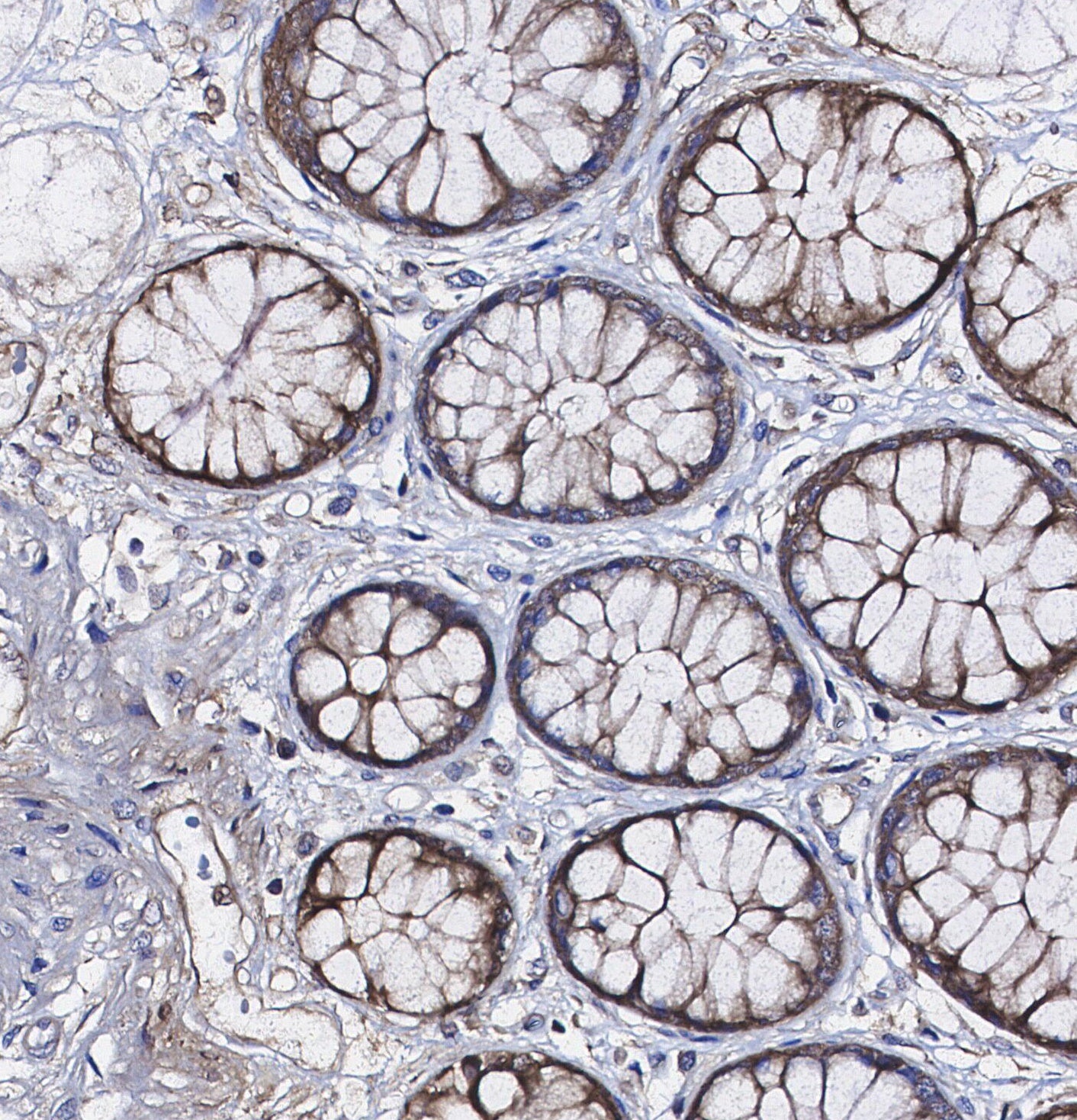 ATPB Antibody
