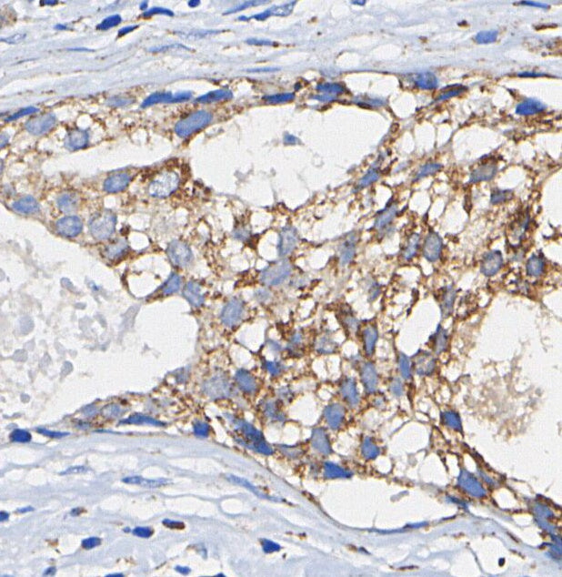 Myeloperoxidase Heavy Chain Antibody