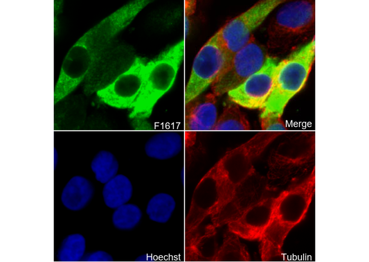 S100 β Antibody