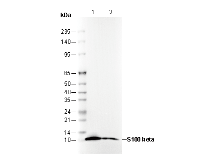 S100 β Antibody