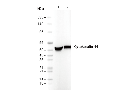 Cytokeratin 14 Antibody