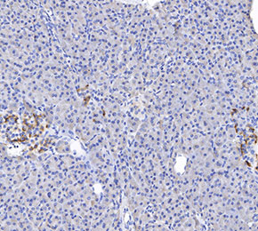 GLP-1 Antibody