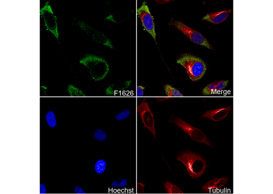 PGK1 Antibody