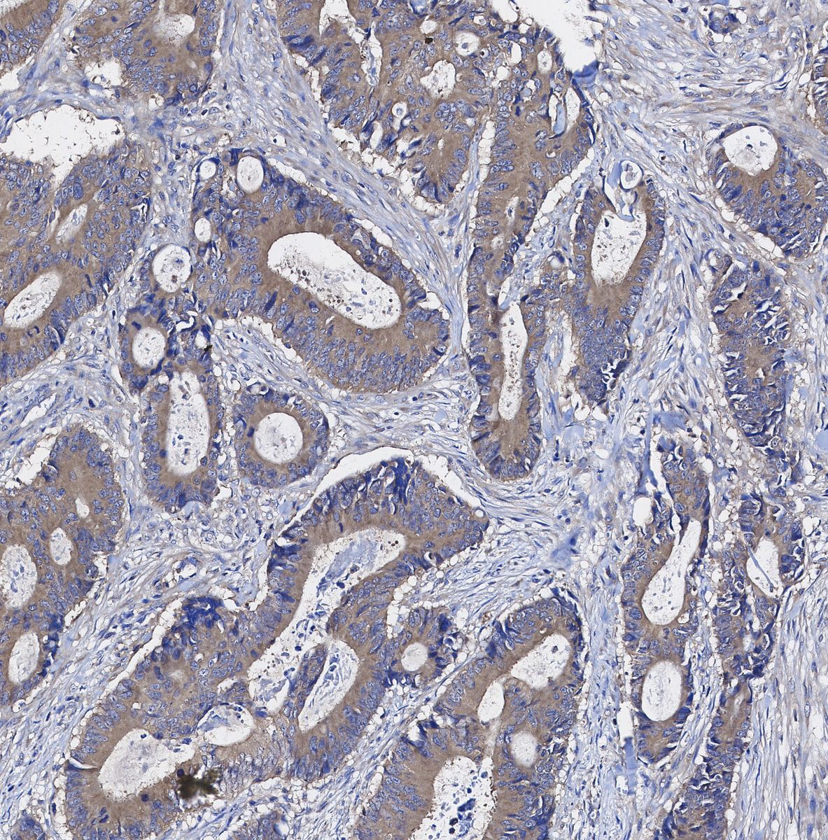 MTCO1 Antibody